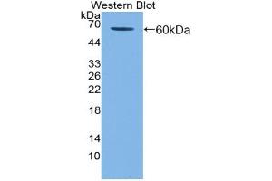 Western blot analysis of the recombinant protein. (KIR2DL3 antibody  (AA 22-342))