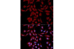Immunofluorescence analysis of U2OS cells using UBE2I antibody. (UBE2I antibody  (AA 1-158))