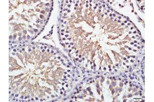 GRINA antibody  (AA 121-220)