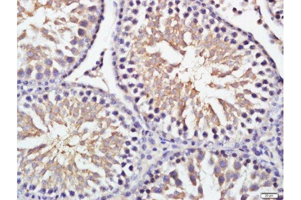 GRINA antibody  (AA 121-220)