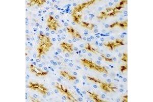 Immunohistochemistry (IHC) image for anti-Receptor-Interacting Serine-threonine Kinase 2 (RIPK2) antibody (ABIN7308278) (RIPK2 antibody)