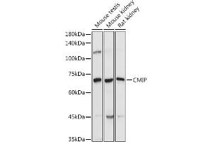 Western blot analysis of extracts of various cell lines, using CMIP antibody (ABIN7265970) at 1:1000 dilution. (CMIP antibody)