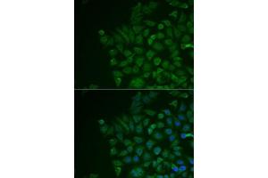 Immunofluorescence analysis of MCF7 cells using LRAT antibody (ABIN6132018, ABIN6143312, ABIN6143315 and ABIN6217189). (LRAT antibody  (AA 1-194))