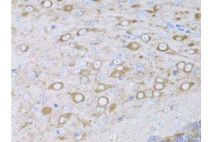 Immunohistochemistry of paraffin-embedded mouse brain using MYH10 antibody. (MYH10 antibody  (AA 1908-2007))