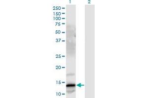 Western Blot analysis of GRP expression in transfected 293T cell line by GRP monoclonal antibody (M03), clone 3A11. (Gastrin-Releasing Peptide antibody  (AA 1-148))
