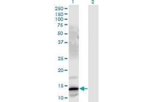 Western Blot analysis of GRP expression in transfected 293T cell line by GRP monoclonal antibody (M03), clone 3A11.