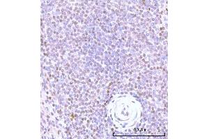 IHC analysis of Nesprin3/SYNE3 using anti-Nesprin3/SYNE3 antibody (ABIN7601328). (Nesprin3 antibody  (AA 322-495))