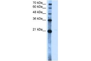 WB Suggested Anti-OLR1 Antibody Titration:  2. (OLR1 antibody  (N-Term))