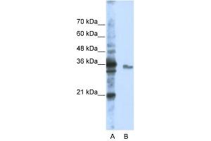 EXOSC3 antibody used at 1 ug/ml to detect target protein. (EXOSC3 antibody  (Middle Region))