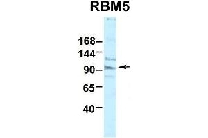 Human HepG2 (RBM5 antibody  (N-Term))