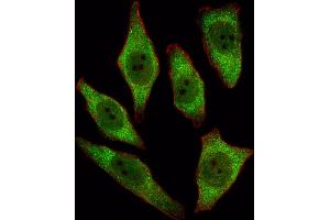 Fluorescent image of A549 cell stained with RT Antibody (N-term) 2893a/SA091009AF. (APRT antibody  (N-Term))