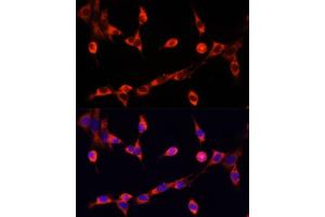 Immunofluorescence analysis of NIH/3T3 cells using CHAT antibody (ABIN6131569, ABIN6138488, ABIN6138490 and ABIN6217173) at dilution of 1:100. (Choline Acetyltransferase antibody  (AA 331-630))