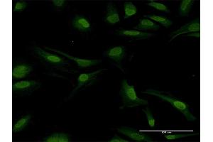 Immunofluorescence of purified MaxPab antibody to PPP2CB on HeLa cell. (PPP2CB antibody  (AA 1-309))