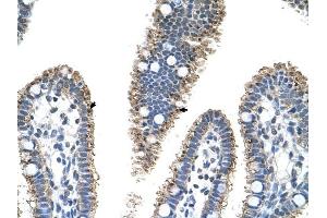 PRODH2 antibody was used for immunohistochemistry at a concentration of 4-8 ug/ml to stain Epithelial cells of intestinal villus (arrows) in Human Intestine.