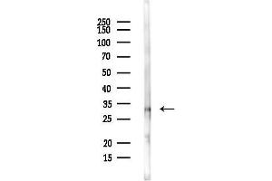 anti-Polycomb Group Ring Finger 3 (PCGF3) antibody