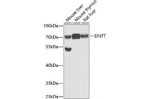 Western blot analysis of extracts of various cell lines using DNTT Polyclonal Antibody at dilution of 1:1000. (TdT antibody)