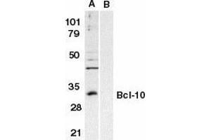 Western blot analysis of Bcl-10 in Raji whole cell lysate in the absence (A) or presence (B) of blocking peptide with Bcl10 antibody at 1 g/ml. (BCL10 antibody  (N-Term))