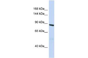 Western Blotting (WB) image for anti-Histocompatibility (Minor) HA-1 (HMHA1) (N-Term) antibody (ABIN2438755) (HMHA1 antibody  (N-Term))