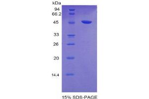 SDS-PAGE (SDS) image for Coagulation Factor VIII (F8) (AA 1669-1824) protein (His tag) (ABIN2120847)
