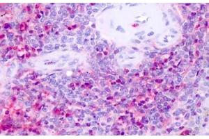 Immunohistochemistry (IHC) image for anti-Nuclear Receptor Subfamily 1, Group D, Member 1 (NR1D1) (Internal Region) antibody (ABIN1049130)