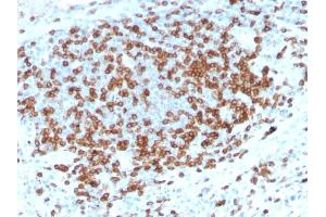 Formalin-fixed, paraffin-embedded human Tonsil stained with CD3e Rabbit Recombinant Monoclonal Antibody (C3e/3125R). (Recombinant CD3 epsilon antibody  (AA 23-119))