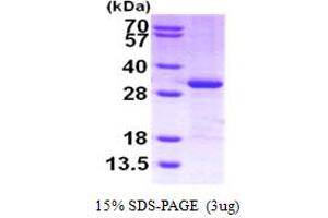 CITED2 Protein (AA 1-270) (His tag)