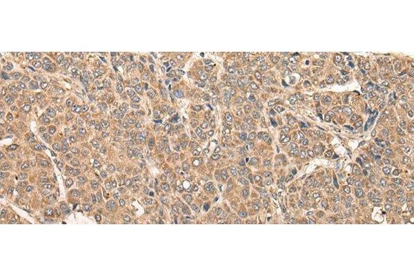 RCAN3 antibody