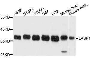 Western blot analysis of extracts of various cell lines, using LASP1 antibody. (LASP1 antibody  (AA 130-205))
