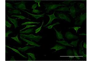 Immunofluorescence of monoclonal antibody to B3GALT2 on HeLa cell. (B3GALT2 antibody  (AA 324-422))