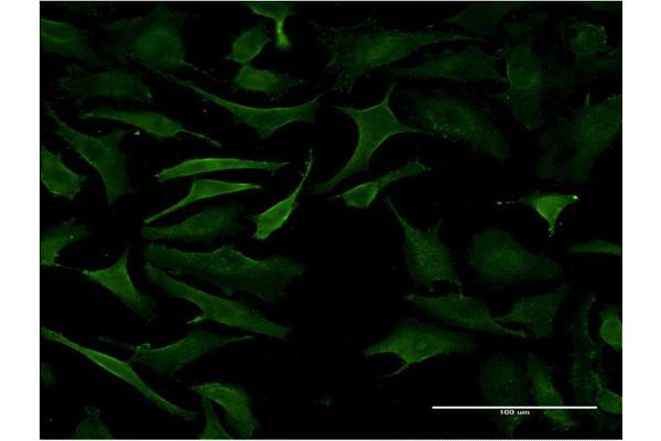 B3GALT2 antibody  (AA 324-422)