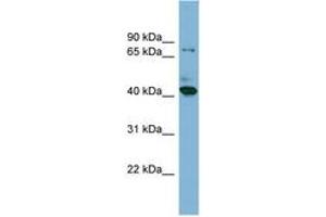 HERPUD2 Antikörper  (N-Term)