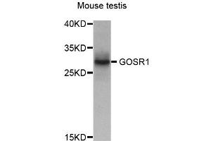 Western blot analysis of extract of various cells, using GOSR1 antibody. (GS28 antibody)