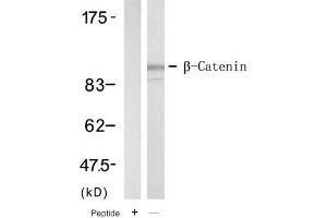Image no. 1 for anti-Catenin (Cadherin-Associated Protein), beta 1, 88kDa (CTNNB1) (Tyr654) antibody (ABIN319394) (CTNNB1 antibody  (Tyr654))