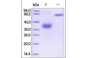 SDS-PAGE (SDS) image for Tumor Necrosis Factor Receptor Superfamily, Member 17 (TNFRSF17) (AA 1-54) (Active) protein (Fc Tag) (ABIN2180644)
