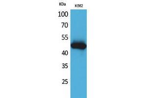 Western Blotting (WB) image for anti-Interleukin 5 Receptor, alpha (IL5RA) (N-Term) antibody (ABIN3187749) (IL5RA antibody  (N-Term))