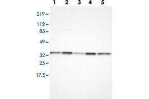 Western blot analysis of Lane 1: RT-4, Lane 2: U-251 MG, Lane 3: A-431, Lane 4: Liver, Lane 5: Tonsil with CYB5R3 polyclonal antibody  at 1:100-1:250 dilution.