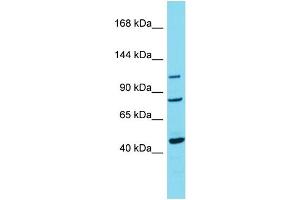 Host:  Rabbit  Target Name:  TRPC7  Sample Type:  Breast Tumor lysates  Antibody Dilution:  1. (TRPC7 antibody  (C-Term))