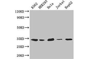 Western Blot Positive WB detected in: K562 whole cell lysate, HEK293 whole cell lysate, Hela whole cell lysate, Jurkat whole cell lysate, HepG2 whole cell lysate All lanes: CDK2 antibody at 2. (CDK2 antibody  (AA 1-298))