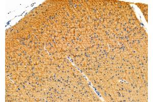ABIN6263422 and ABIN6276330 at 1/100 staining Mouse brain tissue by IHC-P.