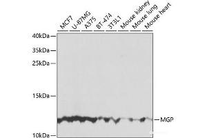 MGP antibody