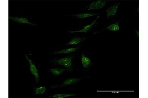 Immunofluorescence of purified MaxPab antibody to MINA on HeLa cell. (MINA antibody  (AA 1-465))