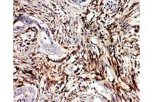 Immunohistochemistry (IHC) image for anti-Neuregulin 1 (NRG1) (C-Term) antibody (ABIN3031973)
