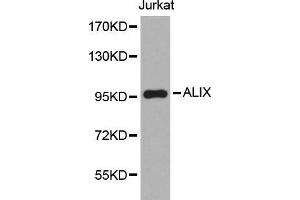 Western blot analysis of extracts of Jurkat cell line, using ALIX antibody.