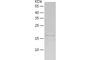 Western Blotting (WB) image for Chromodomain Helicase DNA Binding Protein 2 (CHD2) (AA 260-456) protein (His tag) (ABIN7284290) (CHD2 Protein (AA 260-456) (His tag))