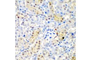 Immunohistochemistry of paraffin-embedded mouse kidney using ADAD1 antibody (ABIN5975411) at dilution of 1/200 (40x lens). (ADAD1 antibody)