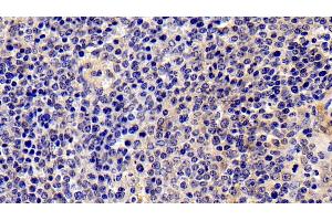 Detection of IL2Ra in Porcine Spleen Tissue using Polyclonal Antibody to Interleukin 2 Receptor Alpha (IL2Ra) (CD25 antibody  (AA 22-245))