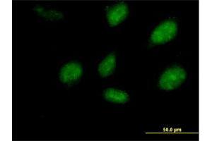 Immunofluorescence of purified MaxPab antibody to PEPP-2 on HeLa cell. (RHOXF2 antibody  (AA 1-288))