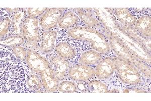 Detection of TFR in Human Kidney Tissue using Monoclonal Antibody to Transferrin Receptor (TFR) (Transferrin Receptor antibody  (AA 567-744))