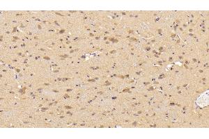 Detection of TH in Rat Cerebrum Tissue using Polyclonal Antibody to Tyrosine Hydroxylase (TH)