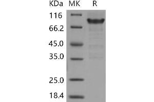 Western Blotting (WB) image for Selectin P Ligand (SELPLG) protein (Fc Tag) (ABIN7320150) (SELPLG Protein (Fc Tag))